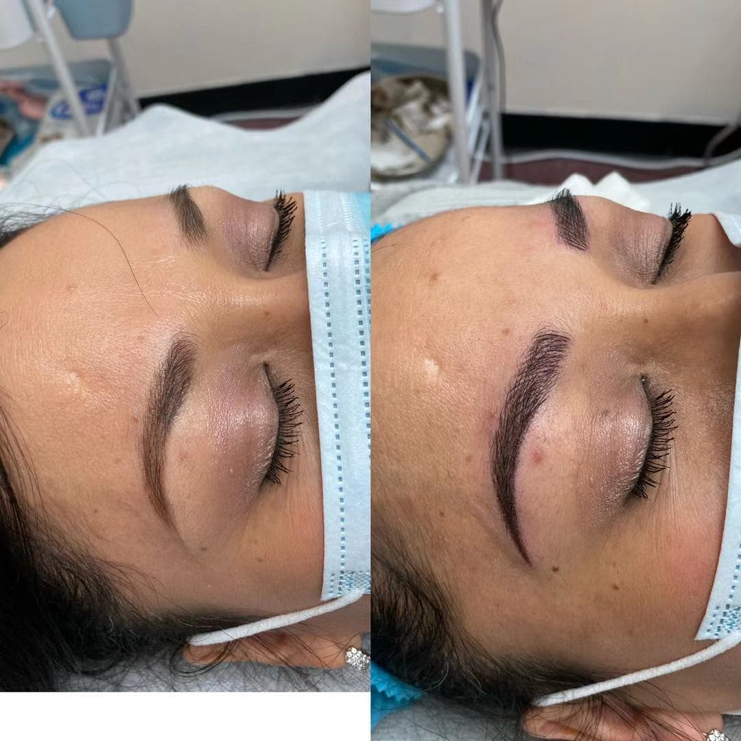 Side-by-side client eyebrow result with added shape and definition